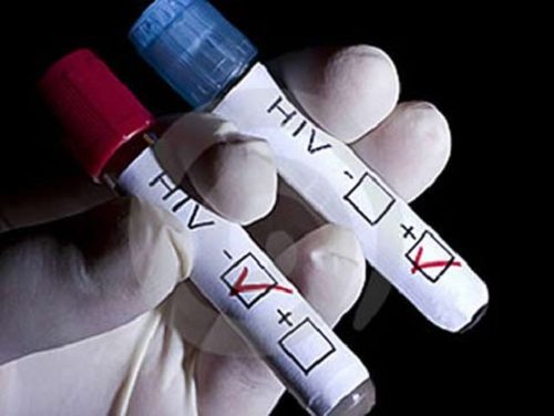 xét nghiệm HIV trước hôn nhân. 