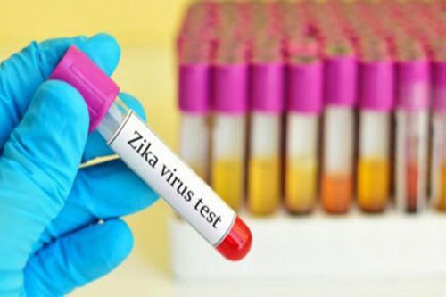 Có thể xét nghiệm virus Zika tại nhiều bệnh viện
