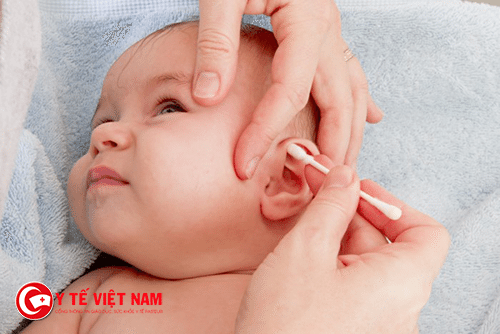 Trẻ bị viêm tai giữa cần điều trị kịp thời và vệ sinh tai cẩn thận
