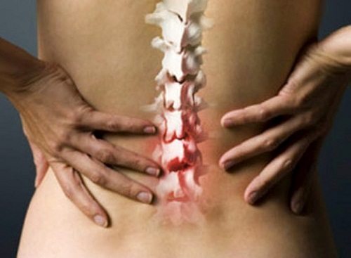 Bệnh Paget xương là nguyên nhân đau nhức cơ thể ở các cơ