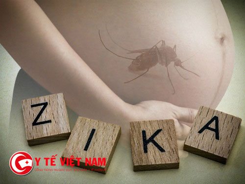 Bà bầu không nên quá lo lắng trước virus Zika