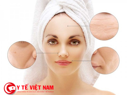 Phương pháp căng da mặt tốt nhất cho phụ nữ trung niên