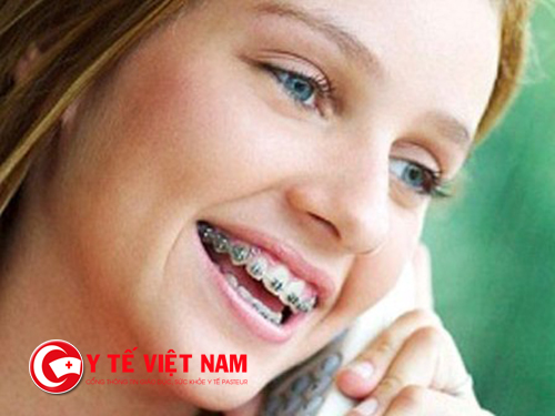 Niềng răng thẩm mỹ là phương pháp nhiều người lựa chọn