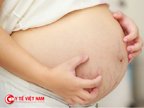 Phụ nữ mang thai nổi mề đay ảnh hưởng nhiều đến sức khỏe thai nhi