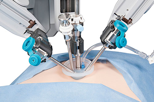 robot trong phẫu thuật chỉnh hình thay khớp