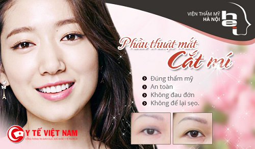 Viện thẩm mỹ Hà Nội là địa chỉ tin cậy dành cho khách hàng khi sử dụng dịch vụ thẩm mỹ mắt