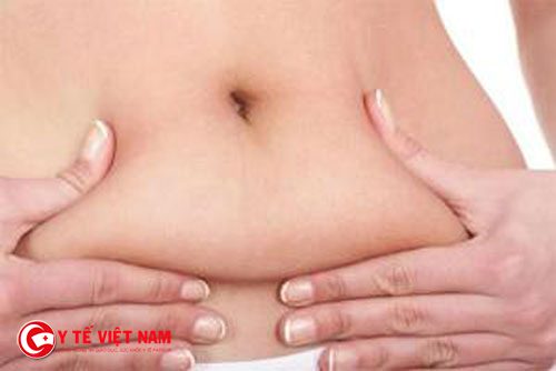 Căng da bụng mini có thể giúp cải thiện da bụng chùng nhão