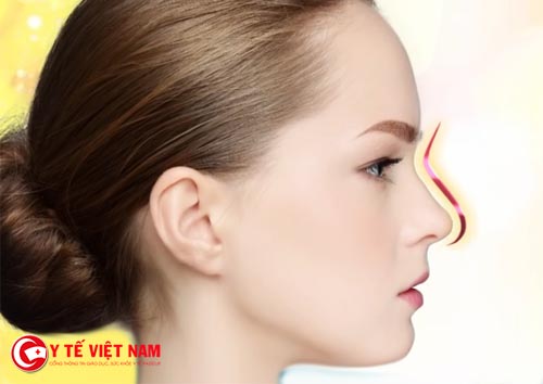 Nâng mũi  Pureform giúp cải thiện dáng mũi hiệu quả