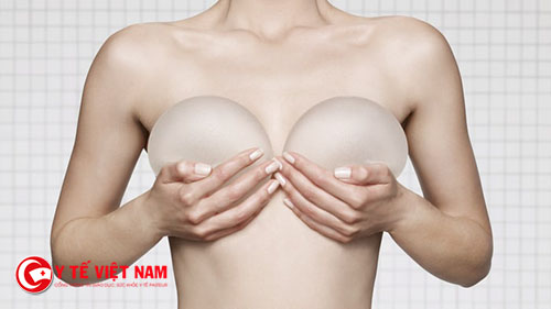 Nên chọn kích thước túi nâng ngực phù hợp với cơ thể