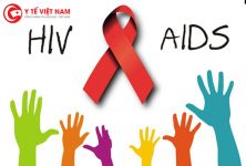 Nhận dạng những dấu hiệu mắc bệnh HIV đầu tiên