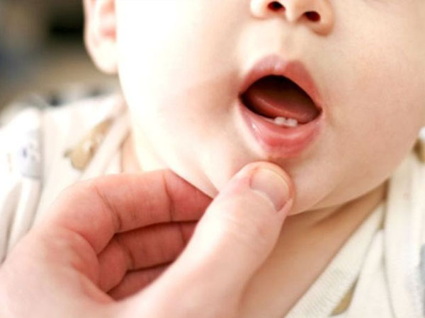 Trẻ bị chậm mọc răng nguyên nhân là do đâu?