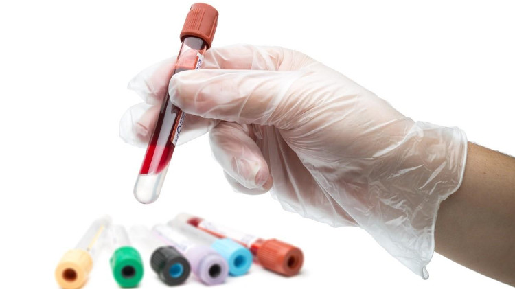 Ý nghĩa các chỉ số xét nghiệm máu cơ bản và phổ biến
