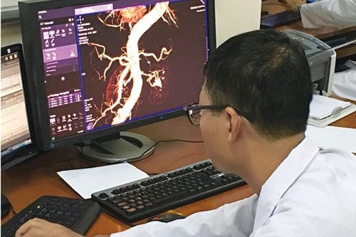 Bác sỹ Phạm Minh Thông - người "vá mạch não" đầu tiên ở Việt Nam - 2