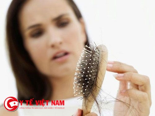 Khi nào thì phải chữa trị rụng tóc?