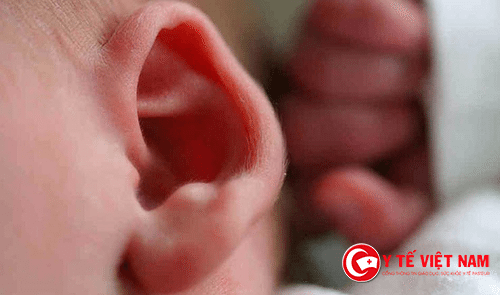 Viêm tai giữa ở trẻ có thể do phần ống thông của tai giữa và mụi bị sưng