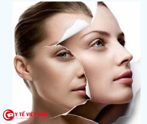 Phương pháp căng da mặt nội soi hiệu quả Phương pháp căng da mặt nội soi hiệu quả