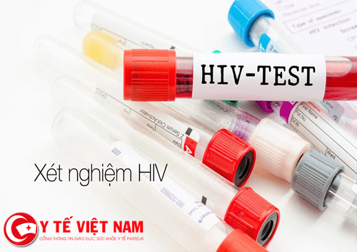Xét nghiệm HIV để có kết luận bệnh chính xác nhất