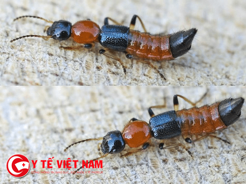 Nọc độc của kiến ba khoang gấp 12-15 lần rắn hổ