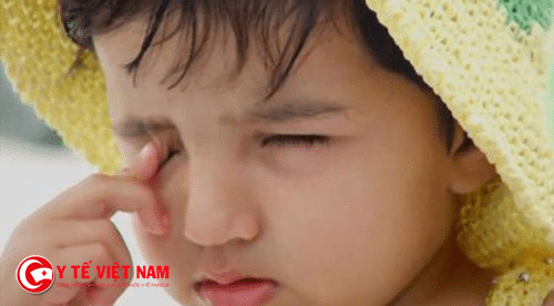 Trẻ thường bị đau mắt, mỏi mắt khi bị loạn thị