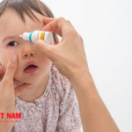 Mẹ nên chăm sóc mắt cho trẻ cẩn thận khi bị đau mắt đỏ