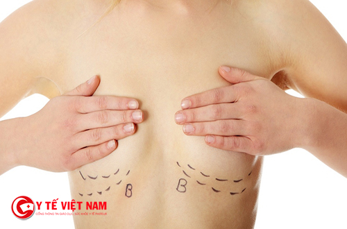 Tôi tìm đến phẫu thuật ngực ở thẩm mỹ viện Hà Nội