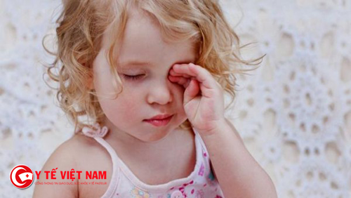 Bạn không nên cho trẻ dụi mắt khi bị đau mắt đỏ