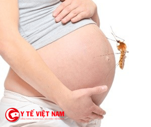 Thai phụ nên bình tĩnh trước Virus Zika