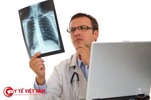 Chụp X-quang phổi thẳng là phương pháp chuẩn đoán chính xác nhất