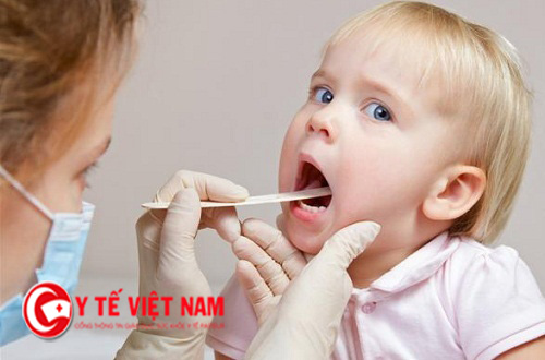 Trẻ em là đối tượng dễ nhiễm bệnh viêm amidan do sức đề kháng yếu