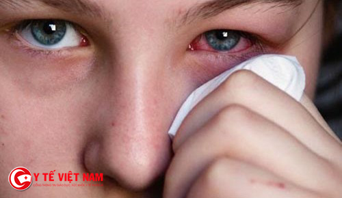 Biến chứng về mắt vô cùng nguy hiểm có thể dẫn đến hư hỏng mắt