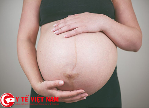 Cứu sống sản phụ mang thai ngoài tử cung