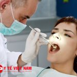 Chăm sóc sau khi lấy cao răng thế nào để có hàm răng trắng sáng?