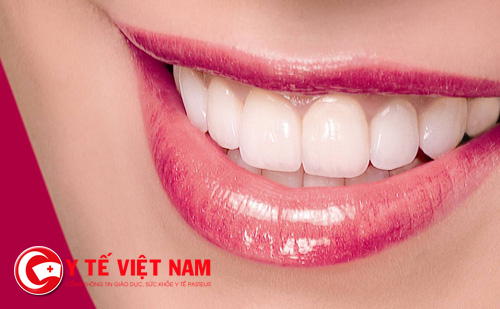 Thẩm mỹ răng hô - Cách đơn giản nhất để bạn có một hàm răng đẹp