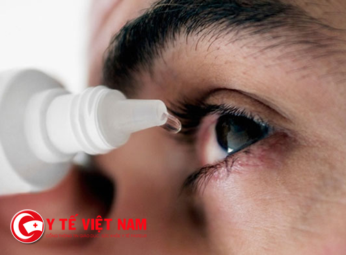 Đau mắt đỏ là một trong những bệnh thường gặp vào mùa mưa