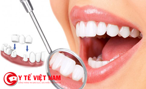 Chăm sóc răng miệng tốt giúp bạn ổn định lượng đường trong máu