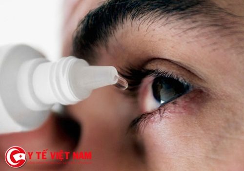 Nguyên nhân và triệu chứng gây bệnh đau mắt đỏ