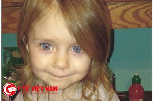 Kỳ lạ: Cô bé 3 tuổi chuẩn bị rút ống thở thì sống lại kỳ diệu