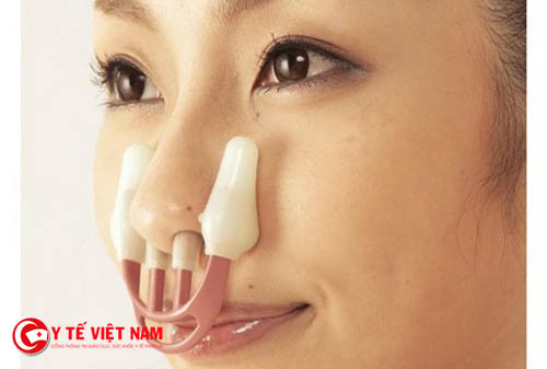 Các chuyên gia thẩm mỹ không khuyến khích sử dụng kẹp mũi
