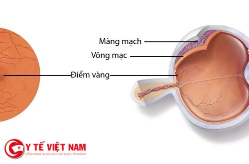 Thuốc trị bệnh thoái hóa võng mạc bẩm sinh tại Mỹ có giá đắt nhất thế giới Thuốc trị bệnh thoái hóa võng mạc bẩm sinh tại Mỹ có giá đắt nhất thế giới