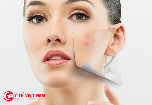 Sử dụng tinh chất giúp trị mụn xóa thâm tốt nhất Sử dụng tinh chất giúp trị mụn xóa thâm tốt nhất