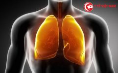Điểm danh các “thủ phạm” giấu mặt gây ung thư phổi