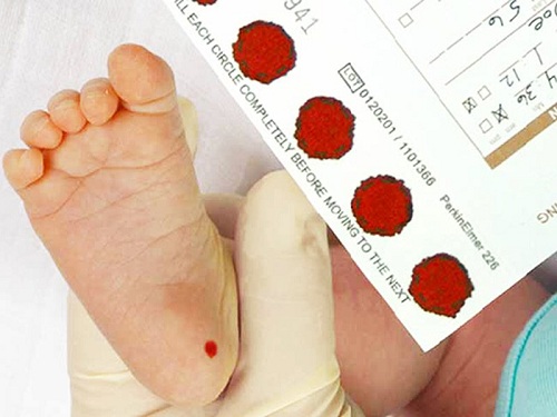 Nên hay không nên tiến hành xét nghiệm lấy máu gót chân ở trẻ sơ sinh?
