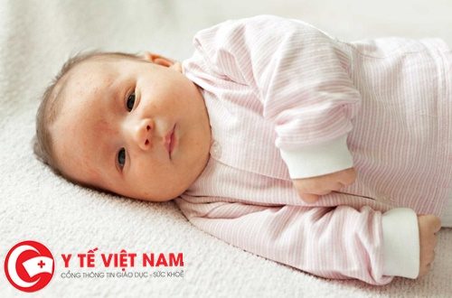 Nhiễm trùng tiết niệu