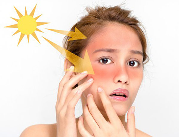 Biện pháp bảo vệ da hiệu quả trong thời tiết nắng nóng cục bộ